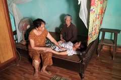 Chị Tình là một trong rất nhiều những hoàn cảnh thương tâm, nạn nhân của hút thuốc thụ động. (Ảnh: PV/Vietnam+)