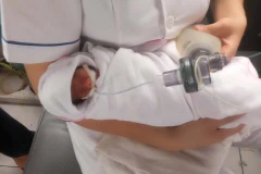Kỳ tích cứu sống và nuôi dưỡng trẻ sơ sinh bé nhất từ trước đến nay