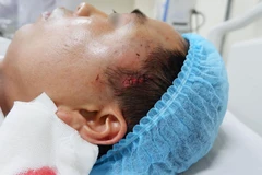 Bệnh nhân được cấp cứu tại Bệnh viện E. (Ảnh: PV/Vietnam+)