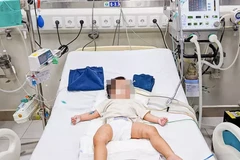 Bé gái đang được điều trị tại Bệnh viện Nhi Trung ương. (Ảnh: BVCC)