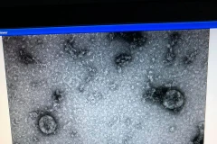 Viện vệ sinh dịch tễ Trung ương đã nuôi cấy và phân lập thành công virus corona mới.