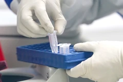 (Ảnh: TTXVN/Vietnam+)