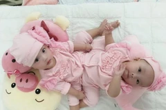 Hai bé gái Trúc Nhi và Diệu Nhi. (Ảnh: BVCC)