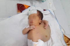 Phẫu thuật cho bệnh nhi sơ sinh có khối u bạch huyết 'khổng lồ'