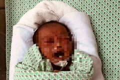 Trẻ sơ sinh bị bỏ rơi. (Ảnh: PV/Vietnam+)