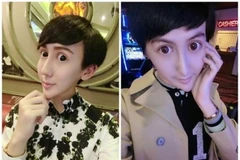 Lưu Tử Thần và gương mặt biến dạng của mình. (Nguồn: shanghaiist.com)