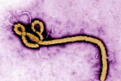 Nhật Bản sẽ nghiên cứu virus ebola. (Nguồn: Kyodo)