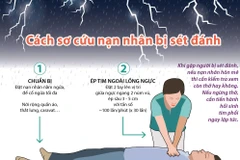 [Infographic] Cách sơ cứu khi gặp nạn nhân bị sét đánh