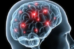 Ảnh minh họa. (Nguồn: nutraingredients.com)