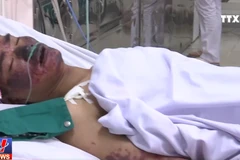 [Video] Cảnh báo nhiễm liên cầu khuẩn lợn do ăn tiết canh