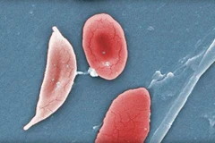 Ảnh minh họa. (Nguồn: AP)