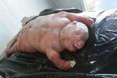 Con cừu con có hình thù kì dị. (Nguồn: Bild)