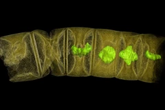 Ảnh chụp tia X hóa thạch giống tảo đỏ. (Nguồn: Reuters)