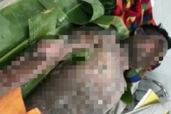 Bạc Liêu: Nổ bếp gas mini, một người đàn ông bị bỏng nặng