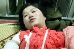 Chị Thủy vẫn chưa hết đau đớn sau vụ tai nạn chiều 30/3. (Ảnh: PV/Vietnam+)