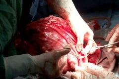 (Ảnh minh họa: Kim Há/TTXVN)