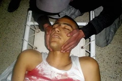 Một người biểu tình bị thương trong cuộc bạo loạn ở thành phố Tala, Tunisia. (Ảnh: AFP/TTXVN)