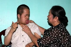 Chăm sóc nạn nhân nhiễm chất độc da cam. (Ảnh: TTXVN)