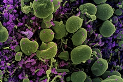 Hình ảnh quét qua kính hiển vi điện tử cho thấy tế bào (màu xanh) bị virus SARS-COV-2 (màu tím) xâm nhập. (Ảnh: AFP/TTXVN)