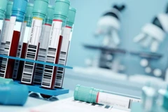 Nga cảnh báo khả năng gia tăng số ca nhiễm virus Tây sông Nile