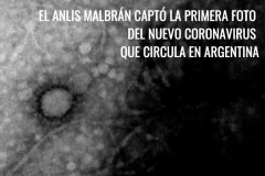 Hình ảnh virus SARS-CoV-2 mà các nhà khoa học Argentina chụp được. (Nguồn: pagina12.com.ar)