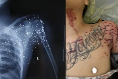 Thái Bình: Khẩn trương điều tra vụ nổ súng làm một người trọng thương