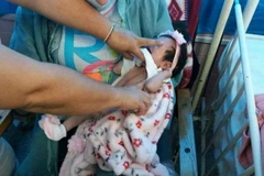 Cuba ghi dấu mốc quan trọng trong phẫu thuật tim ở trẻ sơ sinh