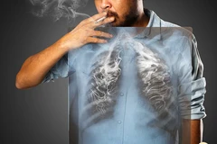 Tọa đàm Xu hướng tiếp cận giải pháp giảm tác hại thuốc lá tại Việt Nam