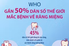 [Infographics] WHO: Gần 50% dân số thế giới mắc bệnh về răng miệng