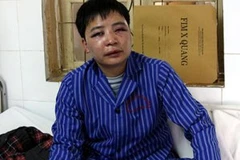 Nhà báo Thế Dũng (báo Người Lao động) bị hành hung dã man tại Lạng Sơn. (Ảnh: NLĐ)