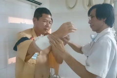 Trung tá Tuyến bị gãy tay phải sau khi bị ném gạch (Ảnh: CQCN cung cấp) 