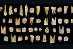 Những chiếc răng khai quật được. (Nguồn: cnn.com)