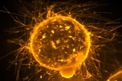 Một tế bào ung thư. (Nguồn: Internet)