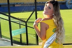 Siêu mẫu Andressa Urach. (Nguồn: Getty)