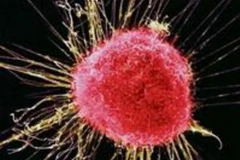 Tế bào ung thư. (Nguồn: Internet)