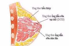 Ảnh chỉ mang tính minh họa. (Nguồn: Internet)