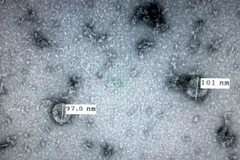 Chủng virus corona mới (nCoV) được Viện vệ sinh dịch tễ Trung ương nuôi cấy và phân lập thành công. (Ảnh: TTXVN phát)