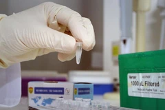 Xét nghiệm xác định virus SARS-CoV-2. (Ảnh: Dương Giang/TTXVN)