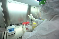 Tách mẫu xét nghiệm COVID-19. (Nguồn: TTXVN)