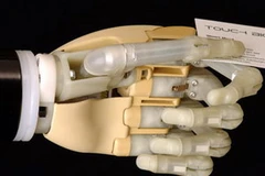 Những "ngón tay điện tử" mở ra hy vọng cho khoảng 1,2 triệu người. (Ảnh: Internet)