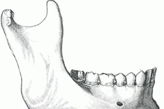 Xương hàm vốn có cấu tạo phức tạp và kích thước lớn nhỏ khác nhau. (Ảnh: Internet)