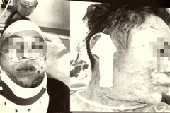 Khẩn trương truy bắt nhóm đối tượng nổ súng làm 2 người bị thương