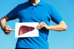 Gan cần được chủ động chống độc và bảo vệ từ gốc để khỏe mạnh lâu dài.