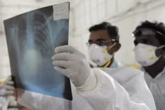 Gần 40 người tử vong vì virus cúm A H1N1 ở Ai Cập