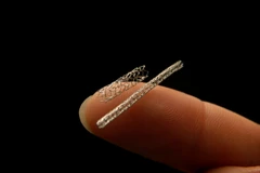 Nga chế tạo thành công ống đỡ động mạch tối ưu hơn