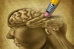 Phát hiện hơn 100 mã ADN đột biến gây chứng tâm thần phân liệt