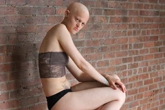 Người mẫu bị dị tật bẩm sinh cởi đồ nhằm phản đối kỳ thị