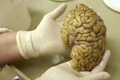 Phát hiện lạnh gáy về bộ lạc ăn thịt người ở Papua New Guinea