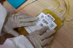 Điều trị COVID-19 bằng huyết tương của bệnh nhân mắc COVID-19 được áp dụng cho các ca bệnh nặng. (Ảnh: THX/TTXVN)