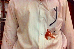 Bị tố sai phạm, chủ doanh nghiệp thuê người chém chủ tịch Hội Nông dân